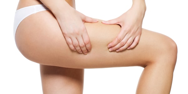 Jak pozby� si� cellulitu? 9 domowych sposob�w