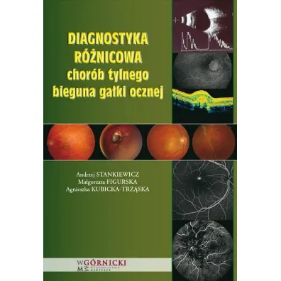 Diagnostyka r�nicowa chor�b tylnego bieguna ga�ki ocznej - Andrzej Stankiewicz, Ma�gorzata Figurska, Agnieszka Kubicka-Trz�ska