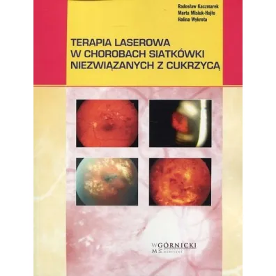 Terapia laserowa w chorobach siatk�wki niezwi�zanych z cukrzyc� - Marta Misiuk-Hoj�o, Halina  Wykrota