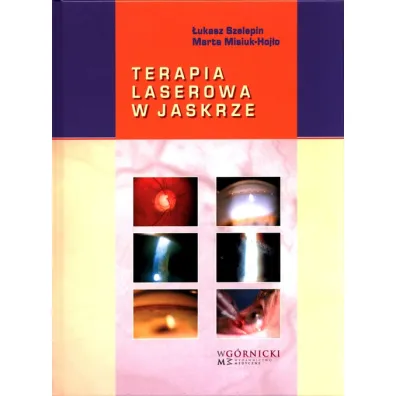 Terapia laserowa w jaskrze - Marta Misiuk-Hoj�o, �ukasz  Szelepin
