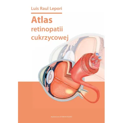 Atlas retinopatii cukrzycowej - Luis Raul Lepori