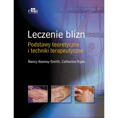 Leczenie blizn pourazowych - Ryan Cathy, Smith Nancy  Keeney