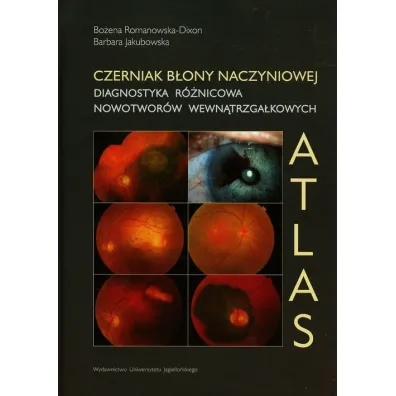 Czerniak b�ony naczyniowej. Diagnostyka r�nicowa - Barbara Jakubowska, Bo�ena Romanowska-Dixon