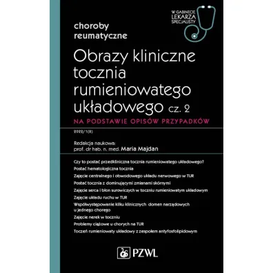 Obrazy kliniczne tocznia rumieniowatego uk�adowego. Cz�� 2. Na podstawie opis�w przypadk�w. Choroby reumatyczne. W gabinecie lekarza specjalisty - Maria  Majdan