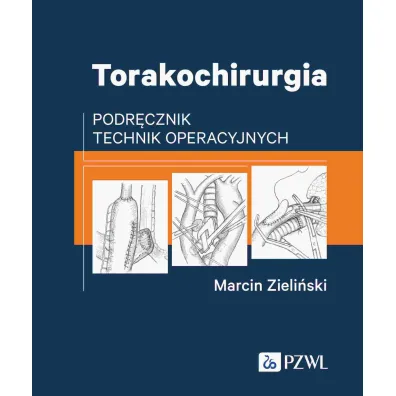Torakochirurgia - Marcin Zieli�ski