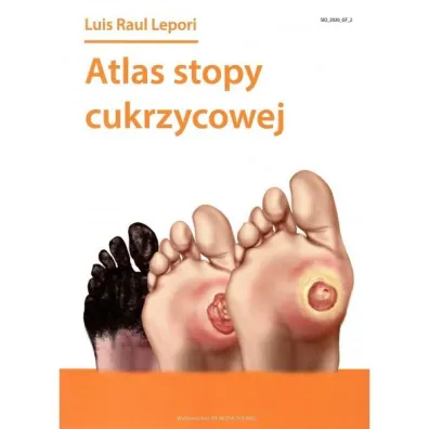 Atlas stopy cukrzycowej - Luis Raul Lepori
