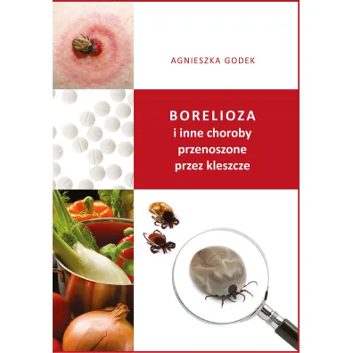 Borelioza i inne choroby przenoszone przez kleszcze - Agnieszka Godek