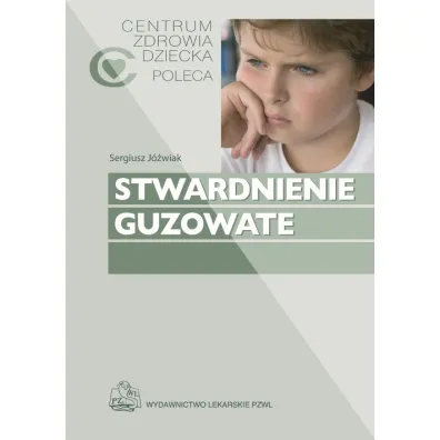 Stwardnienie guzowate - Katarzyna Kotulska-J�wiak, J�wiak Sergiusz