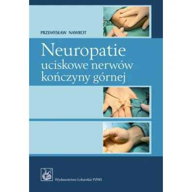 Neuropatie uciskowe nerw�w ko�czyny g�rnej - Przemys�aw Nawrot