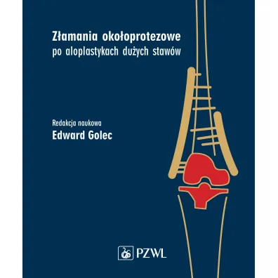 Z�amania oko�oprotezowe po aloplastykach du�ych staw�w - Edward  Golec