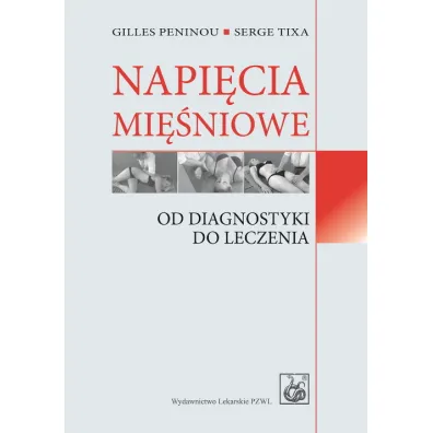 Napi�cia mi�niowe. Od diagnostyki do leczenia - Peninou Gilles, Serge Tixa