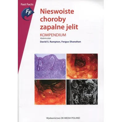 Nieswoiste choroby zapalne jelit. Kompendium - Fergus Shanahan, David S Rampton