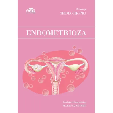 Endometrioza - S Chopra