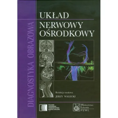 Diagnostyka obrazowa Uk�ad nerwowy o�rodkowy