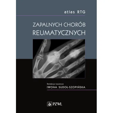 Atlas RTG zapalnych chor�b reumatycznych - Iwona Sudo�-Szopi�ska