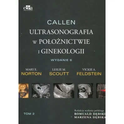 Callen. Ultrasonografia w po�o�nictwie i ginekologii. Tom 2 - Vickie A. Feldstein, Mary E. Norton, Leslie M. Scoutt