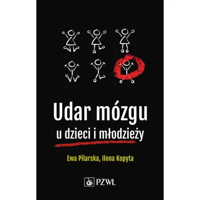 Udar m�zgu u dzieci i m�odzie�y - Ewa  Pilarska, Edyta  Szurowska, Ilona  Kopyta, Robert  Sabiniewicz