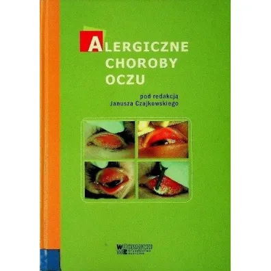Alergiczne choroby oczu - Janusz  Czajkowski, Ewa  Bogacka, J�zef  Ma�olepszy