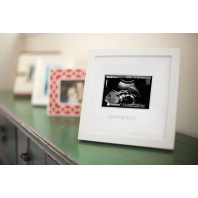 Ramka na zdj�cie USG "Sonogram"