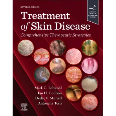 Treatment of Skin Disease: Comprehensive Therapeutic Strategies