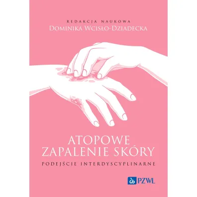 Atopowe zapalenie sk�ry. Podej�cie interdyscyplinarne - Dominika Wcis�o-Dziadecka
