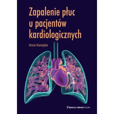 Zapalenie p�uc u pacjent�w kardiologicznych - Anna  Konopka