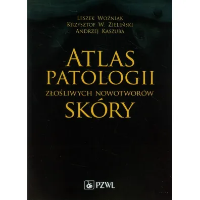 Atlas patologii z�o�liwych nowotwor�w sk�ry - Andrzej Kaszuba, Leszek Wo�niak, Krzysztof W. Zieli�ski