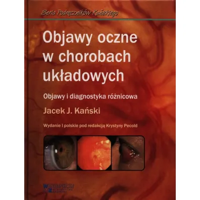 Objawy oczne w chorobach uk�adowych - Jacek J Ka�ski