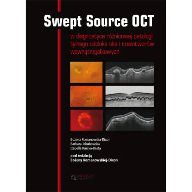Swept Source OCT w diagnostyce patologii tylnego bieguna oka i nowotwor�w wewn�trzga�kowych - Barbara Jakubowska, Bo�ena Romanowska-Dixon, Izabella  Karska-Basta