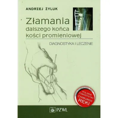 Z�amania dalszego ko�ca ko�ci promieniowej. Diagnostyka i leczenie - Andrzej �yluk