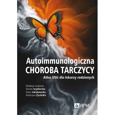 Autoimmunologiczna choroba tarczycy - Katarzyna �yci�ska, Alicja  Jakubowska, Dorota  Szydlarska