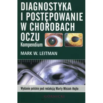 Diagnostyka i post�powanie w chorobach oczu. Kompendium - Mark W Leitman