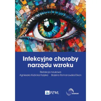 Infekcyjne choroby narz�du wzroku - Bo�ena Romanowska-Dixon, Agnieszka Kubicka-Trz�ska