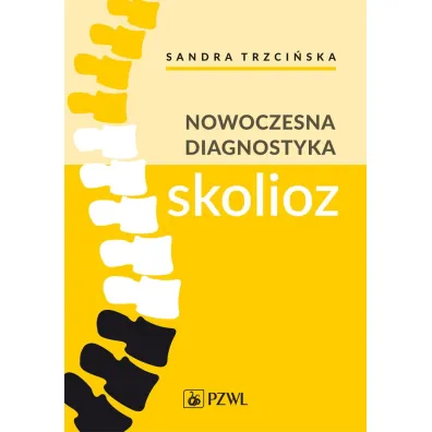 Nowoczesna diagnostyka skolioz - Sandra  Trzci�ska