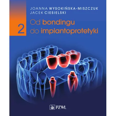 Od bondingu do implantoprotetyki. Cz�� 2 - Jacek  Ciesielski, Joanna Wysoki�ska-Miszczuk