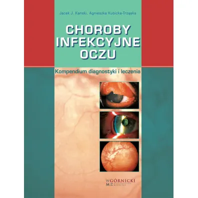 Choroby infekcyjne oczu. Kompendium diagnostyki i leczenia - Jacek J Ka�ski, Agnieszka Kubicka-Trz�ska