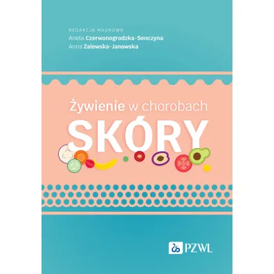 �ywienie w chorobach sk�ry - Anna Zalewska-Janowska, Aneta  Czerwonogrodzka-Senczyna