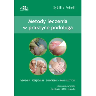 Metody leczenia w podologii - Sybille Feindt