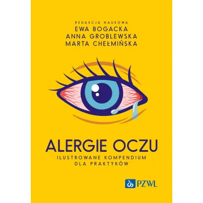 Alergie oczu. Ilustrowane kompendium dla praktyk�w - Ewa  Bogacka, Anna  Groblewska, Marta  Che�mi�ska