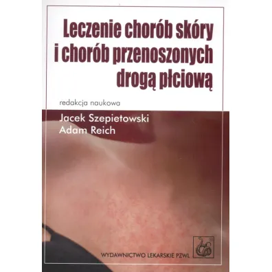 Leczenie chor�b sk�ry i chor�b przenoszonych drog� p�ciow� - Adam Reich, Jacek Szepietowski