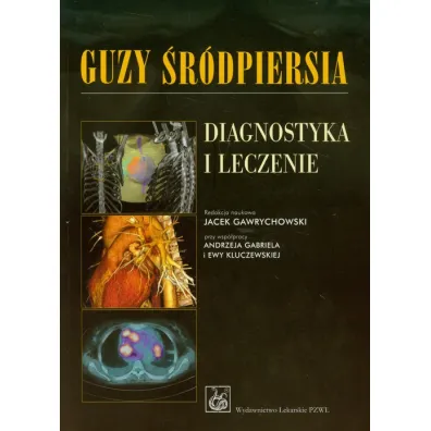 Guzy �r�dpiersia. Diagnostyka i leczenie - Jacek Gawrychowski
