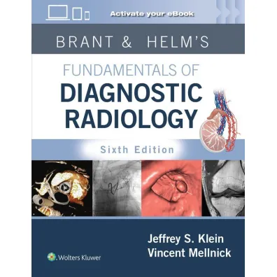 Brant & Helms` Fundamentals of Diagnostic Radiology: Print + eBook with Multimedia - Jeffrey  Klein, Vincent  Mellnick