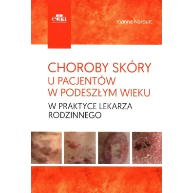 Choroby sk�ry u pacjent�w w podesz�ym wieku w praktyce lekarza rodzinnego - Joanna Narbutt