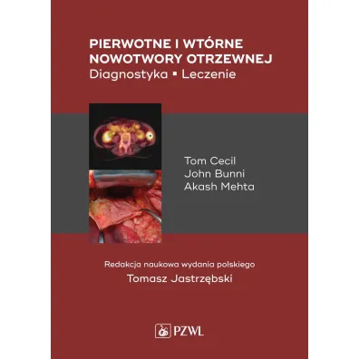 Pierwotne i wt�rne nowotwory otrzewnej - Cecil Tom, John  Bunni, Mehta Akash