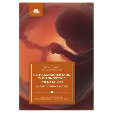 Ultrasonografia 3D w diagnostyce prenatalnej - Rabih Chaoui