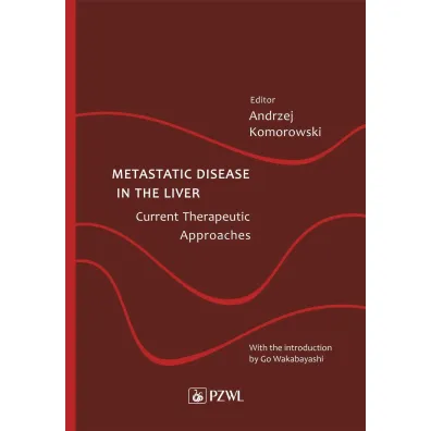 Metastatic Disease in the Liver - Andrzej Komorowski