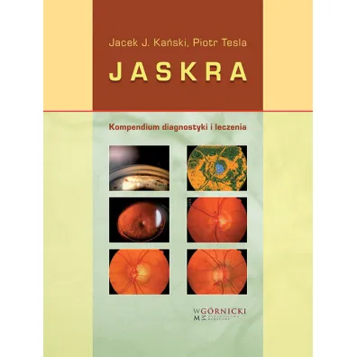 Jaskra. Kompendium diagnostyki i terapii - Jacek J Ka�ski, Piotr Tesla