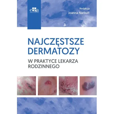 Najcz�stsze dermatozy w praktyce lekarza rodzinn.