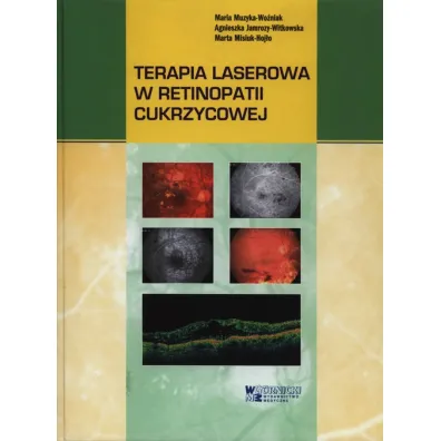Terapia laserowa w retinopatii cukrzycowej - Marta Misiuk-Hoj�o, Agnieszka Jamrozy-Witkowska, Maria Muzyka-Wo�niak