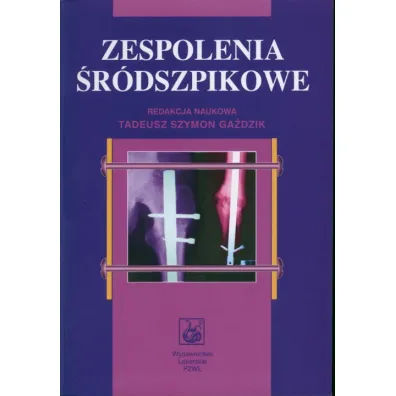 Zespolenia �r�dszpikowe - Szymon Ga�dzik